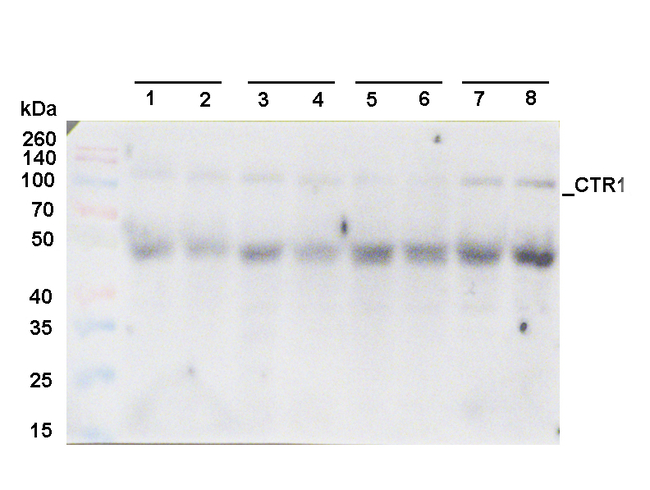 CTR1/Constitutive triple response 1 Antibody in Western Blot (WB)