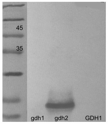 GDH2/Glutamate dehydrogenase 2 Antibody in Western Blot (WB)
