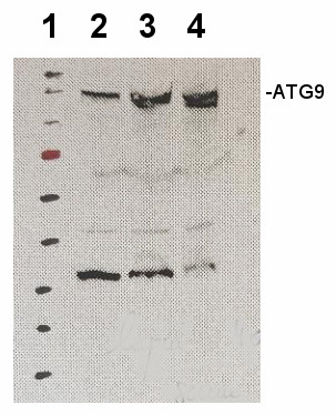 ATG9/Autophagy-related protein 9 Antibody in Western Blot (WB)
