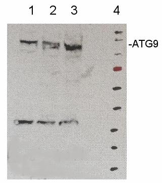 ATG9/Autophagy-related protein 9 Antibody in Western Blot (WB)