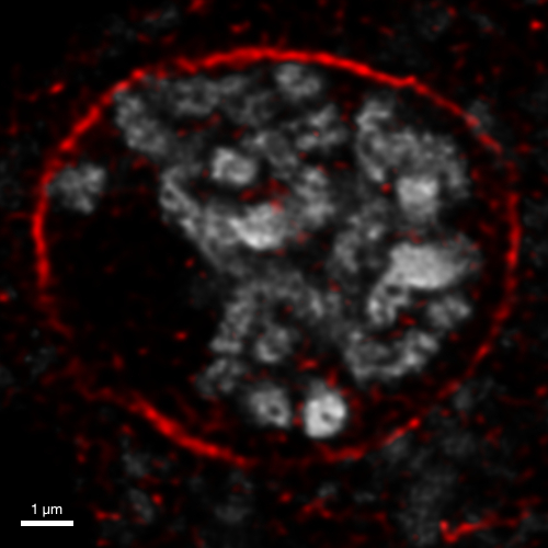SUN1,2/SUN domain-containing protein 1,2 Antibody in Immunocytochemistry (ICC/IF)