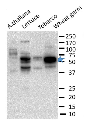 eIF5/Eukaryotic initiation factor eIF5 Antibody in Western Blot (WB)