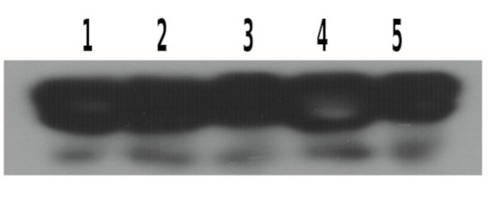 eIF2-alpha/Eukaryotic translation initiation factor 2 subunit alpha Antibody in Western Blot (WB)