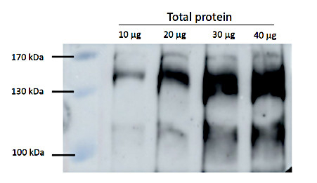 RPB2/DNA-directed RNA polymerase II subunit 2 Antibody in Western Blot (WB)