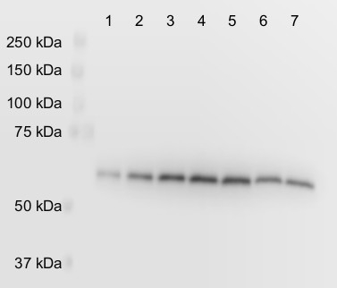 PGDH3/Phosphoglycerate dehydrogenase 3 (chloroplastic) Antibody in Western Blot (WB)