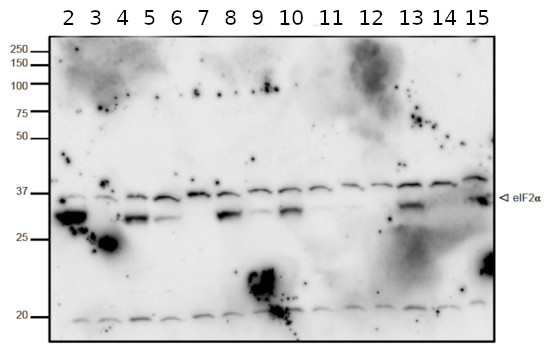 eIF2-alpha-P/Phosphorylated Eukaryotic translation initiation factor 2 subunit alpha Antibody in Western Blot (WB)