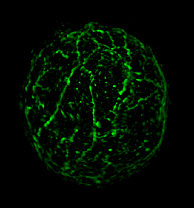 ACT/Actin Antibody in Immunocytochemistry (ICC/IF)