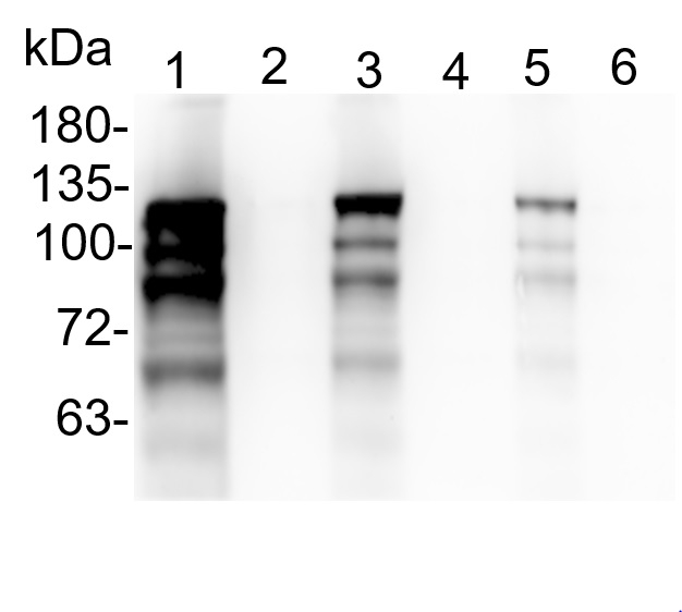 CHLH (GUN5)/Magnesium-chelatase subunit ChlH, chloroplastic Antibody in Western Blot (WB)