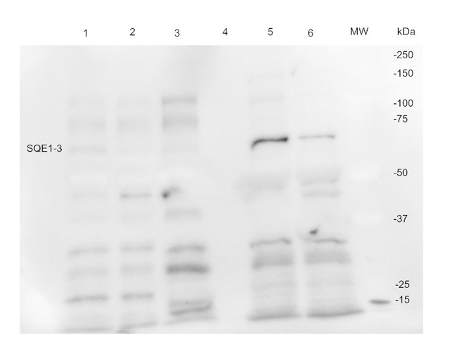 SQE1-3/Squalene epoxidase1-3 Antibody in Western Blot (WB)