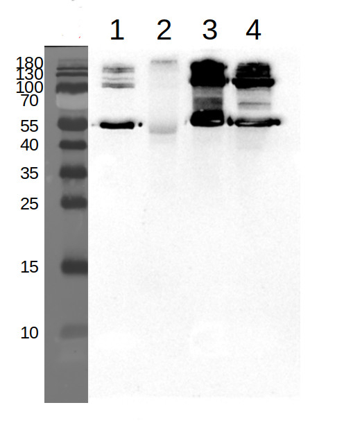 SHMT1/Serine hydroxymethyltransferase 1, mitochondrial Antibody in Western Blot (WB)