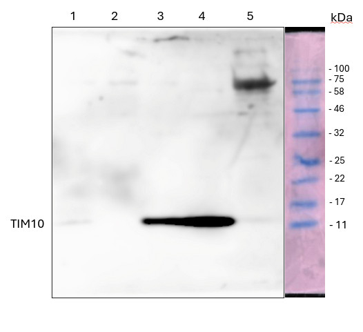 TIM10/Mitochondrial import inner membrane translocase subunit TIM10 Antibody in Western Blot (WB)