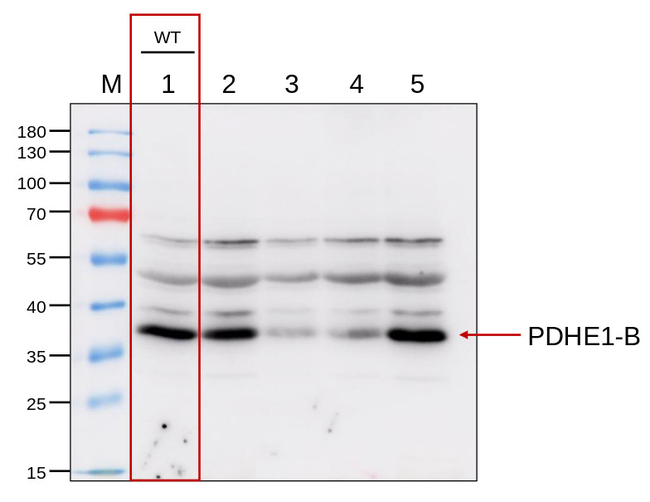 PDHE1-B/Pyruvate dehydrogenase E1 component subunit beta-1, mitochondrial Antibody in Western Blot (WB)