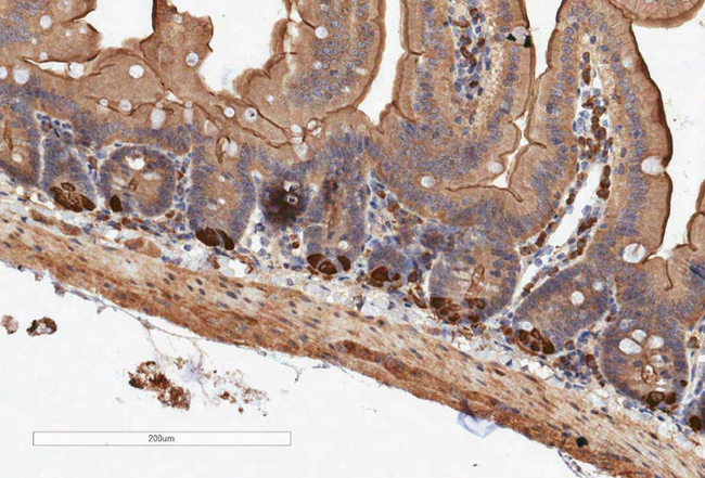 RFP/Red flourescent protein (mRFP, mCherry, tdTomato, mScarlet) Antibody in Immunohistochemistry (Paraffin) (IHC (P))