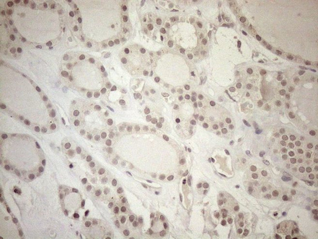 ASB2 Antibody in Immunohistochemistry (Paraffin) (IHC (P))