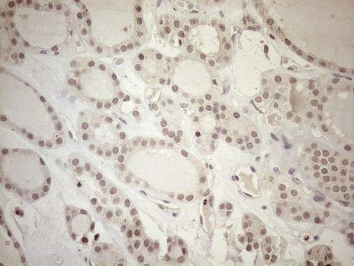 ASB2 Antibody in Immunohistochemistry (Paraffin) (IHC (P))