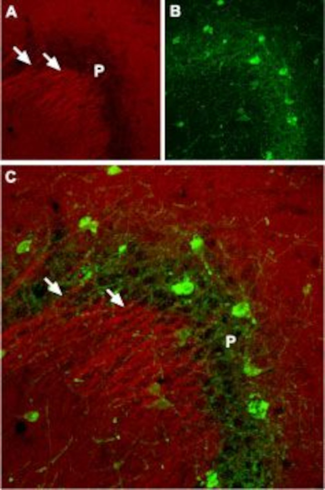 SCN2A (NaV1.2) Antibody in Immunohistochemistry (IHC)
