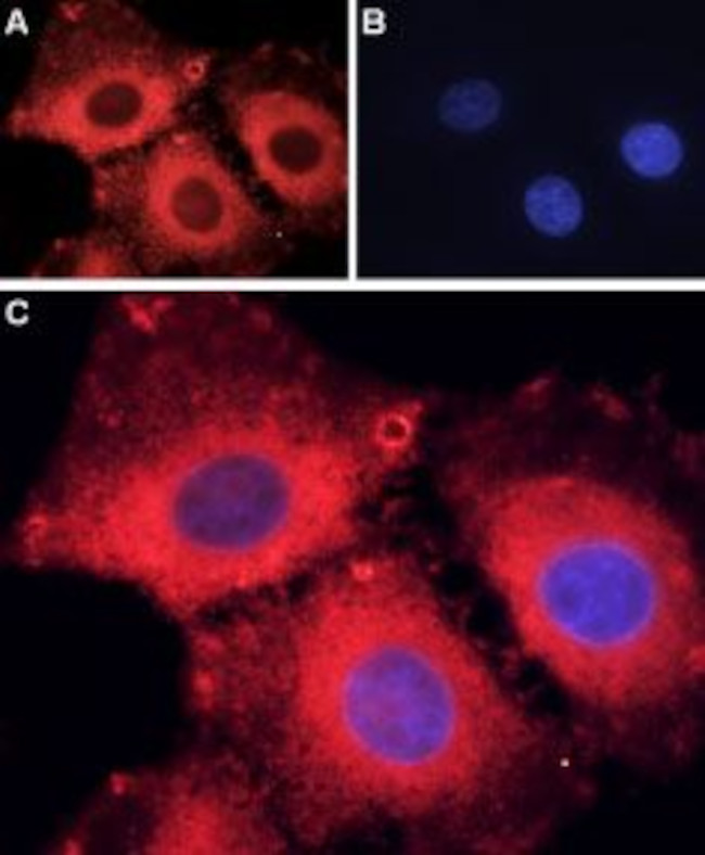 ASIC1 Antibody in Immunocytochemistry (ICC/IF)