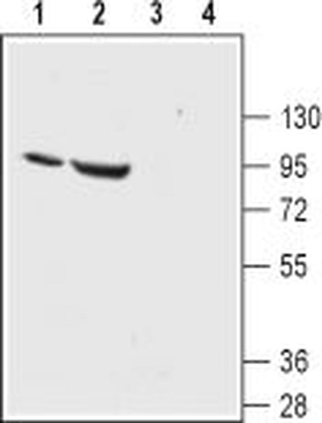 ENaC alpha (SCNN1A) (extracellular) Antibody in Western Blot (WB)