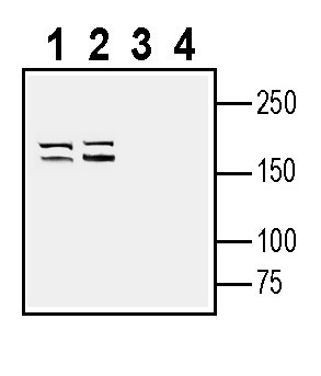 NaV1.5 (SCN5A) (extracellular) Antibody in Western Blot (WB)