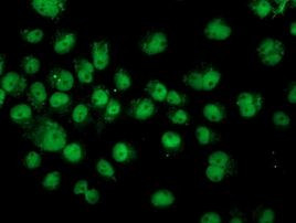 ASCC1 Antibody in Immunocytochemistry (ICC/IF)