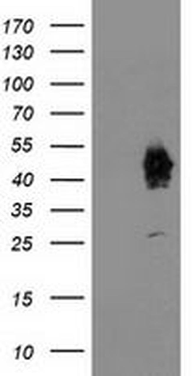 ASCC1 Antibody in Western Blot (WB)