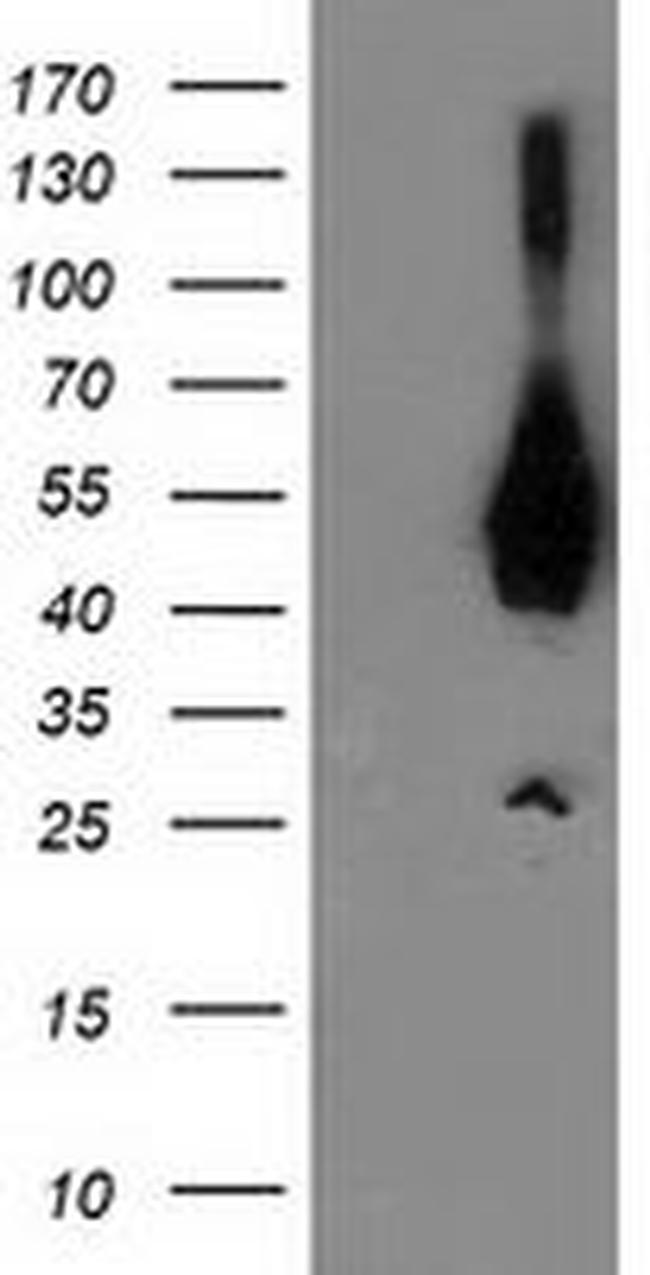 ASCC1 Antibody in Western Blot (WB)
