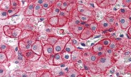 SLC1A4 Antibody in Immunohistochemistry (Paraffin) (IHC (P))