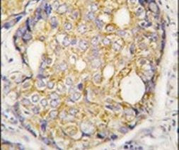 ASK1 Antibody in Immunohistochemistry (IHC)