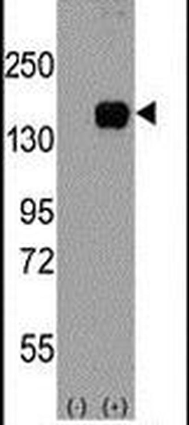 ASK1 Antibody in Western Blot (WB)