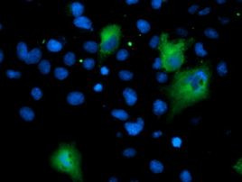 ASNS Antibody in Immunocytochemistry (ICC/IF)