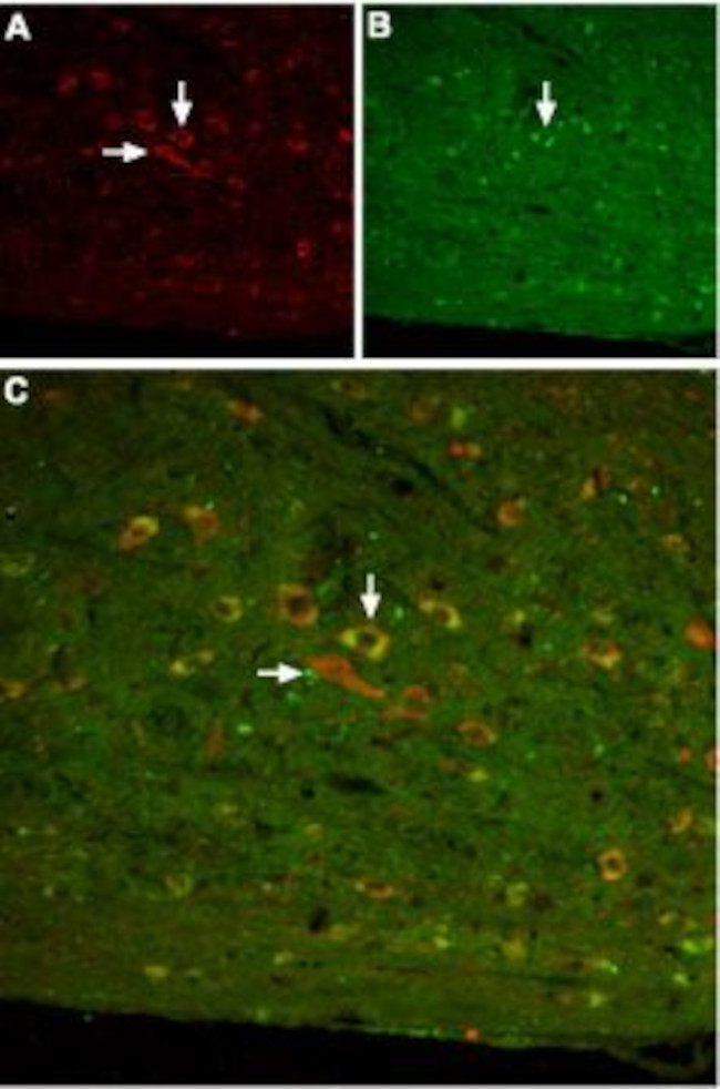 Somatostatin Receptor Type 3 Antibody in Immunohistochemistry (IHC)