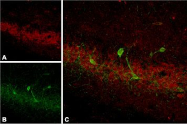 Somatostatin Receptor Type 4 (extracellular) Antibody in Immunohistochemistry (IHC)