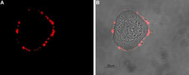 Somatostatin Receptor Type 5 (extracellular) Antibody in Immunocytochemistry (ICC/IF)