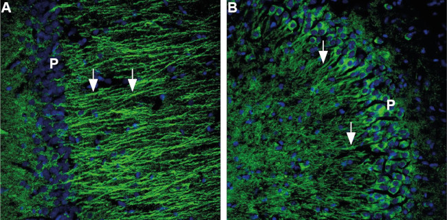 5HT1B Receptor (HTR1B) (extracellular) Antibody in Immunohistochemistry (IHC)