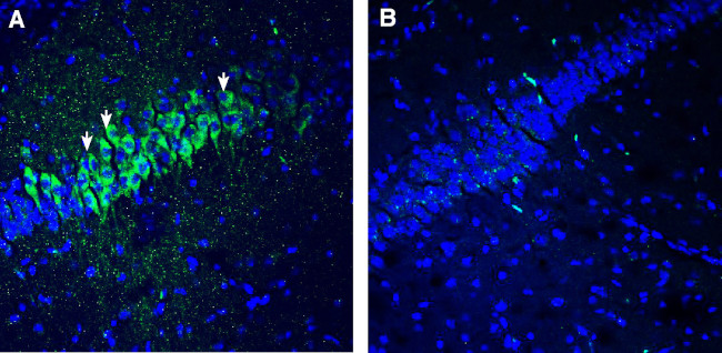 5HT2C Receptor (HTR2C) Antibody in Immunohistochemistry (Frozen) (IHC (F))