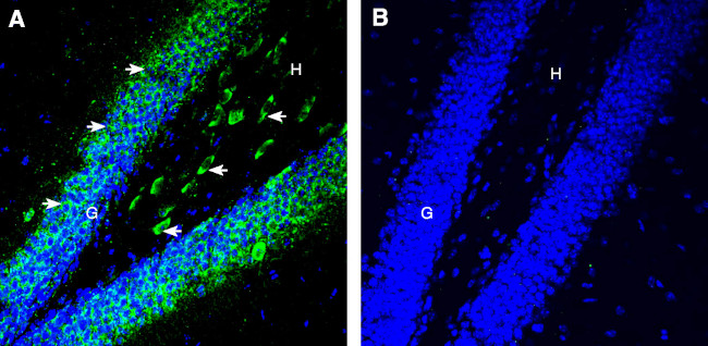 5HT6 Receptor (HTR6) (extracellular) Antibody in Immunohistochemistry (Frozen) (IHC (F))