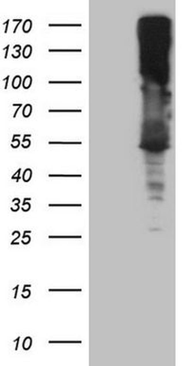ASS1 Antibody in Western Blot (WB)