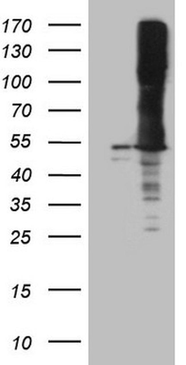ASS1 Antibody in Western Blot (WB)
