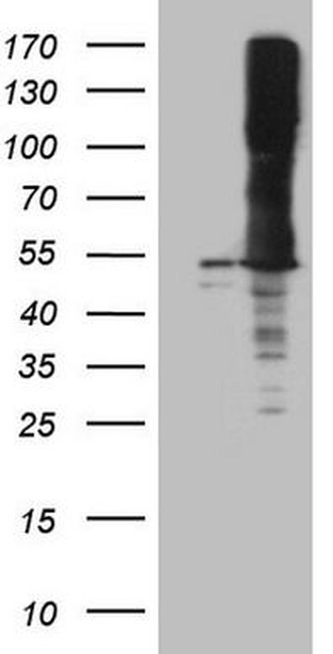 ASS1 Antibody in Western Blot (WB)