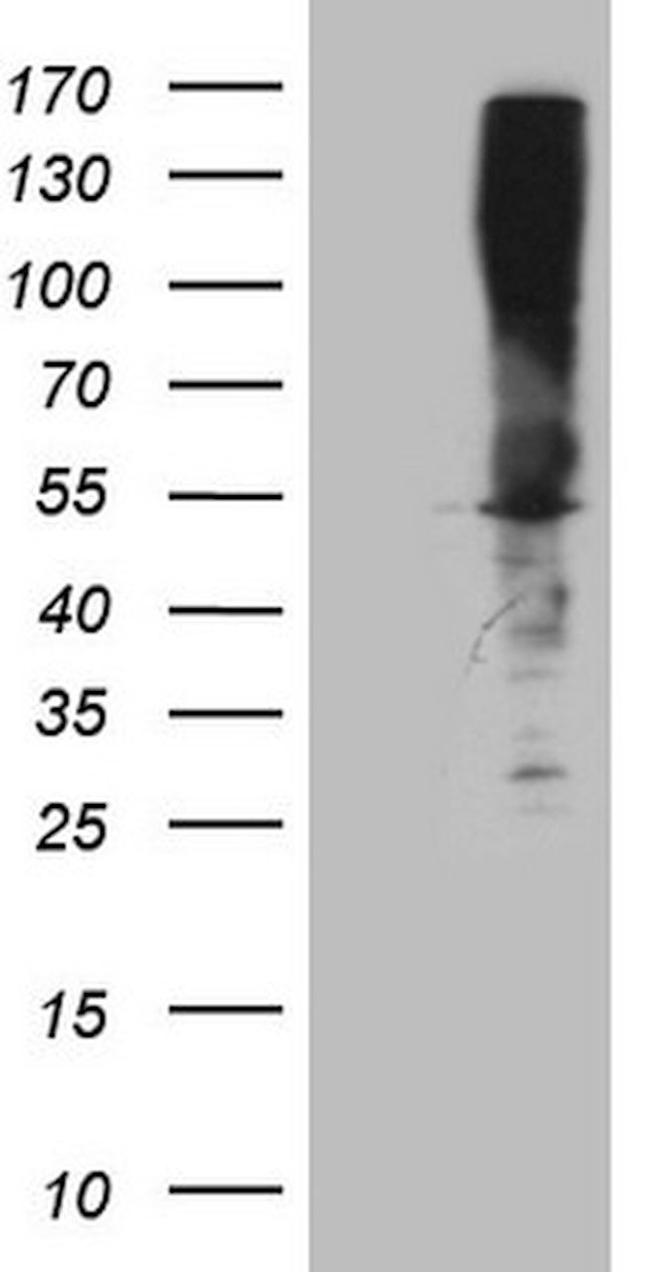 ASS1 Antibody in Western Blot (WB)