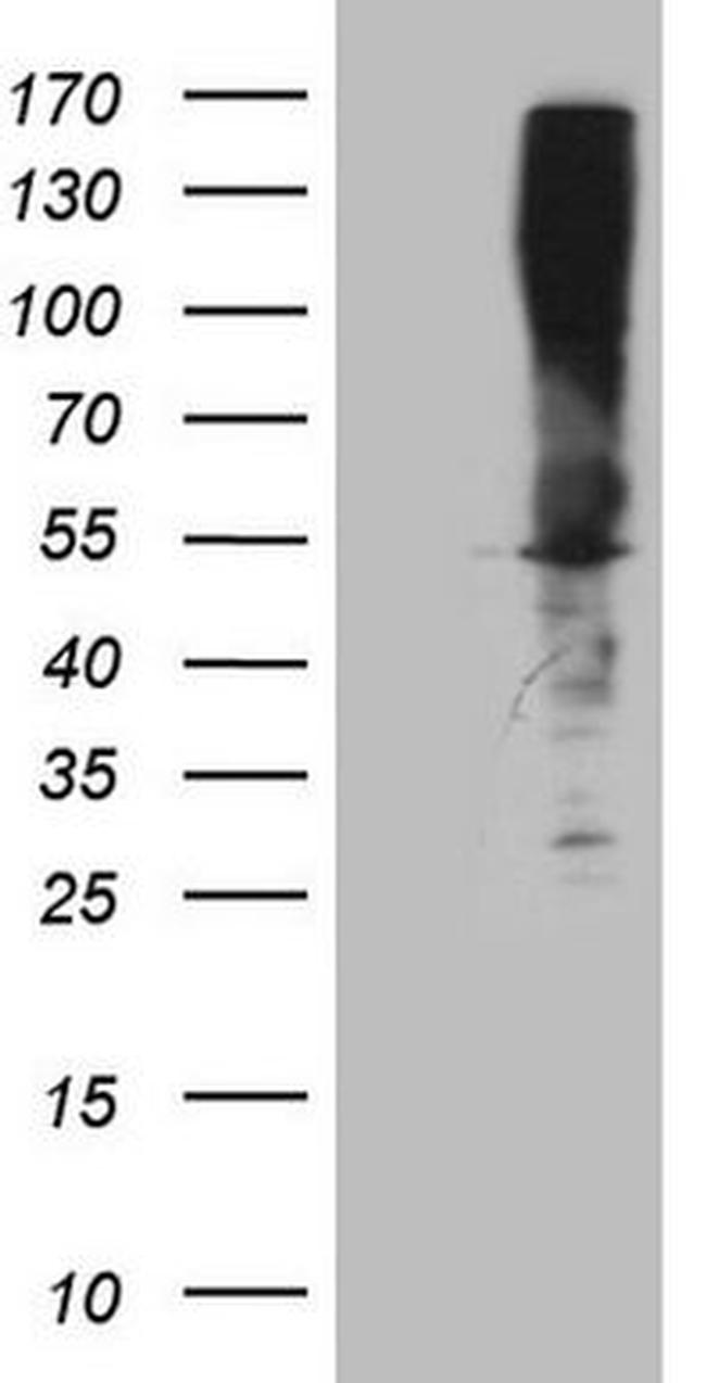 ASS1 Antibody in Western Blot (WB)