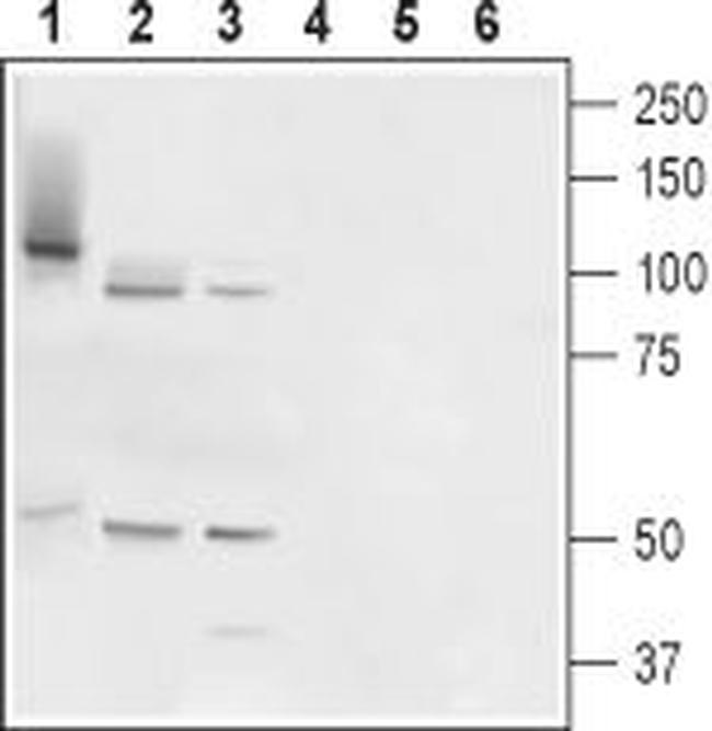 TMC6 (EVER1) Antibody in Western Blot (WB)