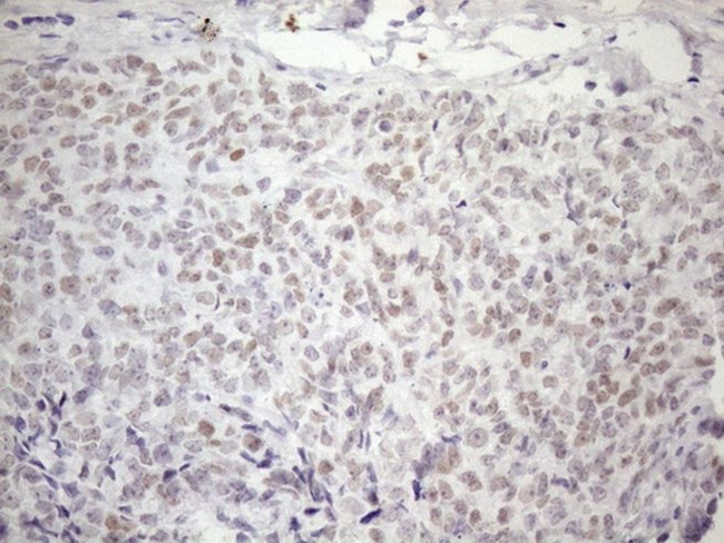 ATF1 Antibody in Immunohistochemistry (Paraffin) (IHC (P))