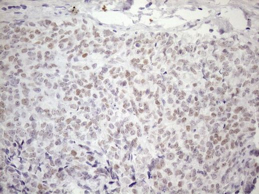 ATF1 Antibody in Immunohistochemistry (Paraffin) (IHC (P))