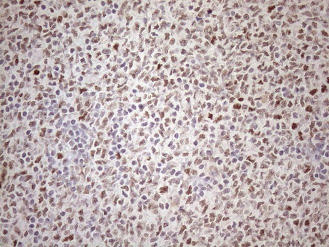 ATF1 Antibody in Immunohistochemistry (Paraffin) (IHC (P))