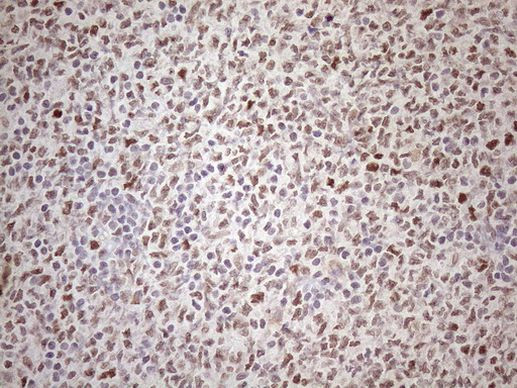 ATF1 Antibody in Immunohistochemistry (Paraffin) (IHC (P))