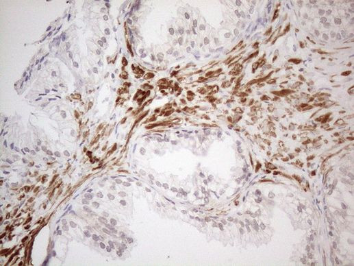 ATF1 Antibody in Immunohistochemistry (Paraffin) (IHC (P))