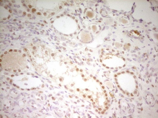 ATF1 Antibody in Immunohistochemistry (Paraffin) (IHC (P))