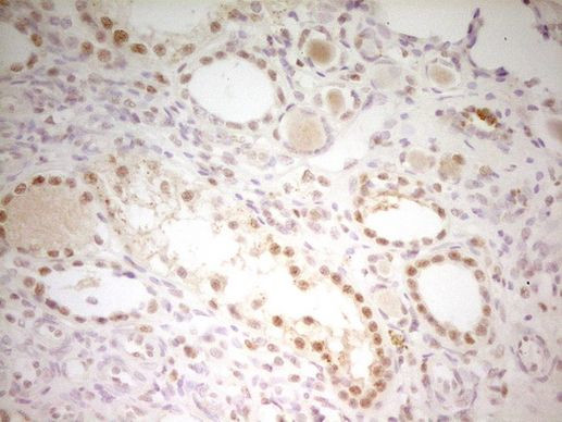 ATF1 Antibody in Immunohistochemistry (Paraffin) (IHC (P))