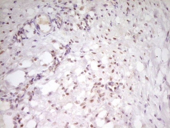 ATF1 Antibody in Immunohistochemistry (Paraffin) (IHC (P))